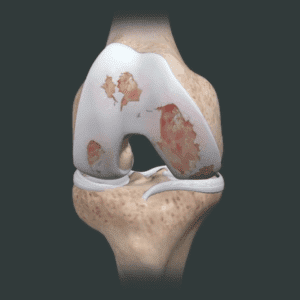 Bone, Joint & Cartilage