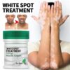 White Spot Disease Vitiligo Balm Repair Ointment Body Skin Care - Free Shipping 01